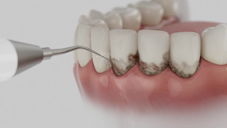 Reliable Dental contractor in Pleasant Hill, TX by Dentist Open Now
